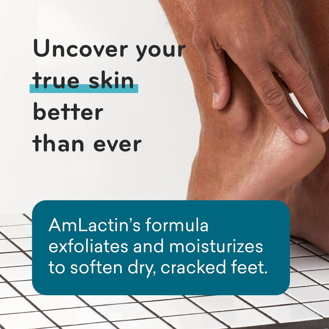Amlactin Foot Repair Cream - 3 Oz Cream for Dry Cracked Heels with 15% Lactic Acid - Exfoliator and Moisturizer for Dry Skin (Packaging May Vary)