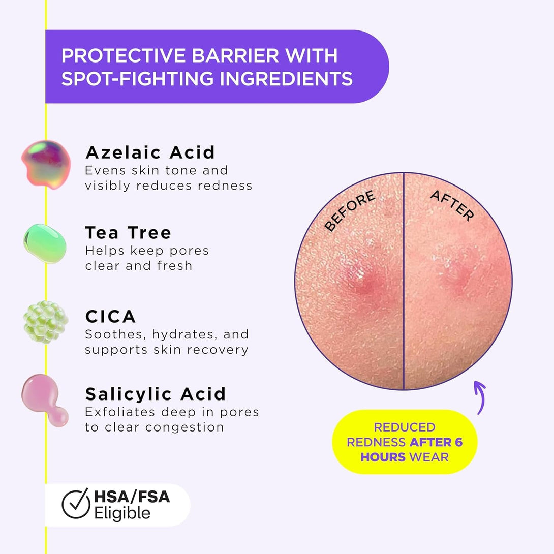 Zitsticka Liquid Pimple Patch - Invisible Pimple Patches for Face, FSA HSA Eligible Pimple Cream, Salicylic Acid Spot Cover for Face, Liquid Pimple Patch Large & Clear Fits to Makeup (0.3Oz, 10Ml)