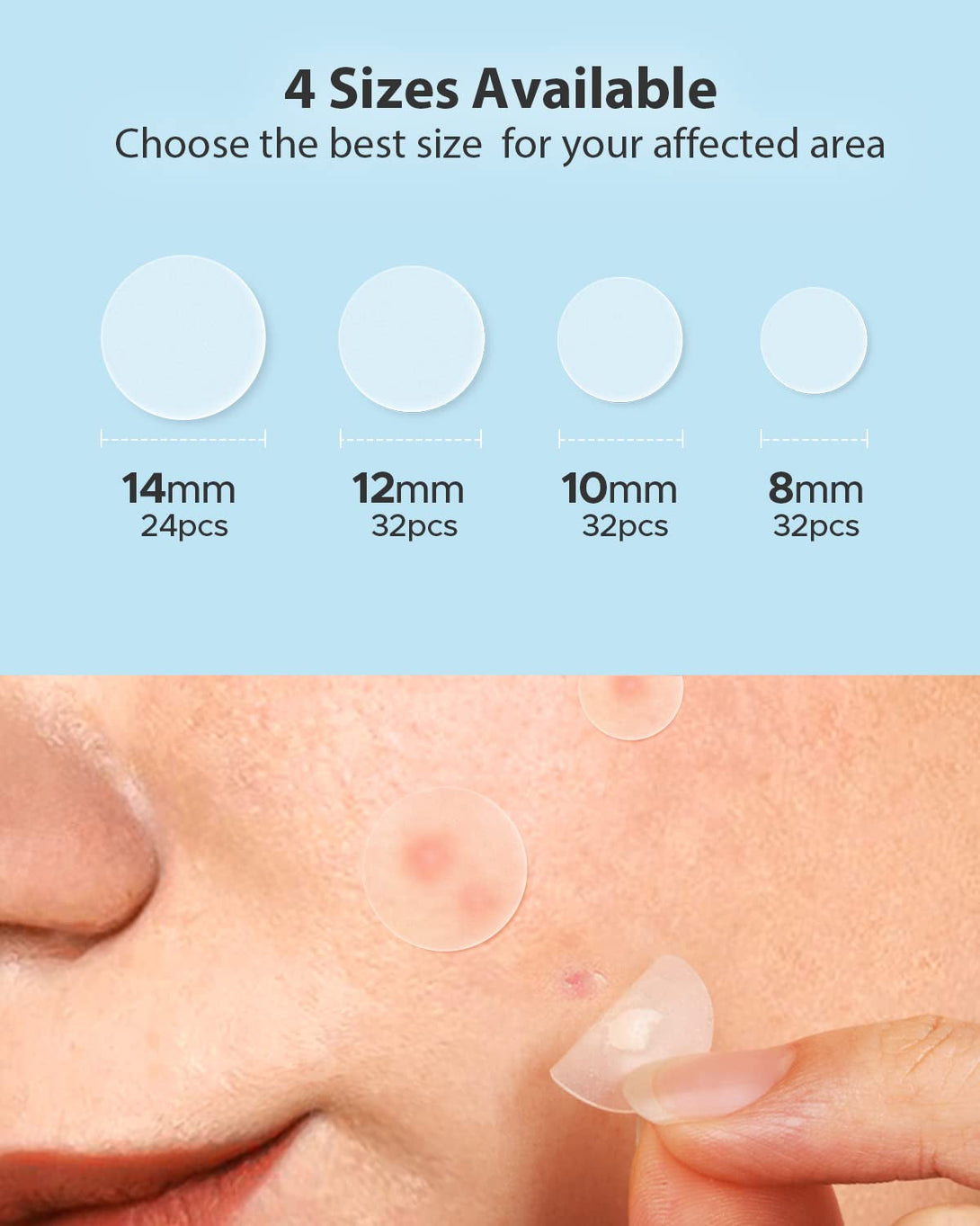 Litbear Acne Pimple Patches- Day and Night 4 Sizes 180 Dots Thin & Thick Hydrocolloid Patches with Witch Hazel, Tea Tree & Calendula Oil, Extra Adhesion for Face Zit Patch Dots