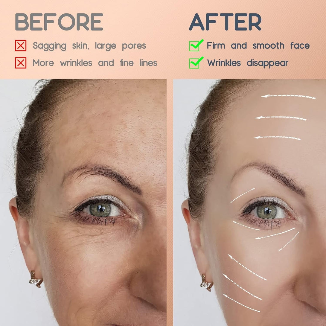 2 Rolls Facial Myofascial Face Lift Tape, Neck & Forehead Smooths Wrinkles, Unisex Anti-Wrinkle Patches for Firming and Tightening Skin