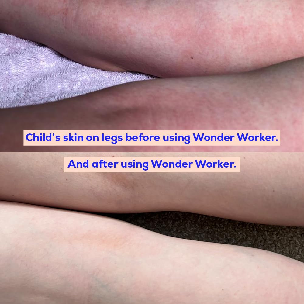 Bloom & Blossom Wonder Worker - Multi-Purpose Healing Balm with Shea Butter & Vitamin E - Natural Moisturizer for Dry Skin & Baby Care