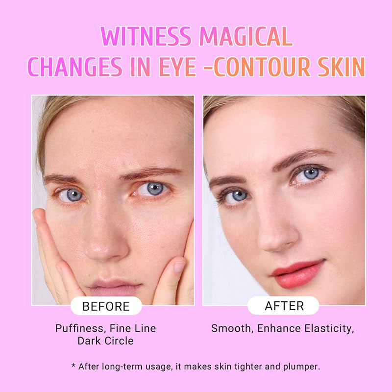 Under Eye Patches Gold and Hyaluronic Acid for Puffy Eyes,Rose Eye Masks for Dark Circles and Puffiness Skin Care Smooth Wrinkles Products 30 Pairs