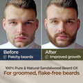 Gya Labs Sandalwood Beard Oil for Men Growth - 100% Pure Natural Beard Growth Oil for Men with Organic Argan & Jojoba - Moisturizes, Softens &