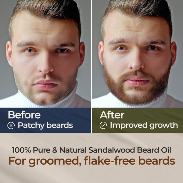 Gya Labs Sandalwood Beard Oil for Men Growth - 100% Pure Natural Beard Growth Oil for Men with Organic Argan & Jojoba - Moisturizes, Softens &