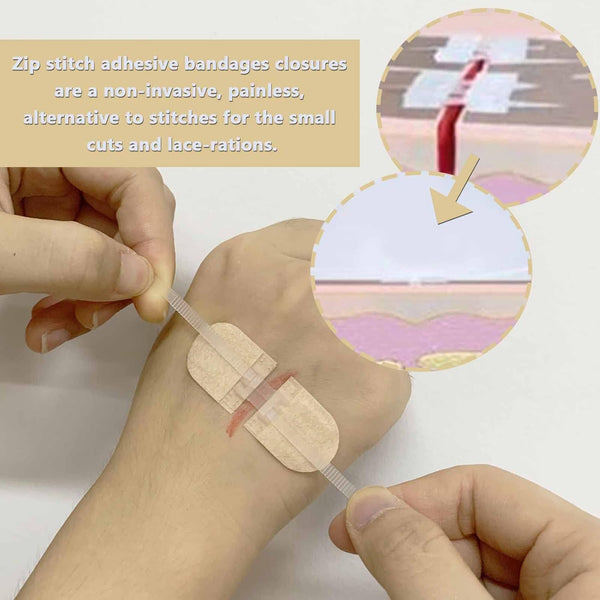 Emergency Wound Closures Adhesive Bandages, Zip Stitch Stickers for Camping, Survival & Household Gear, 3 Pcs (45*10Mm, Skin)