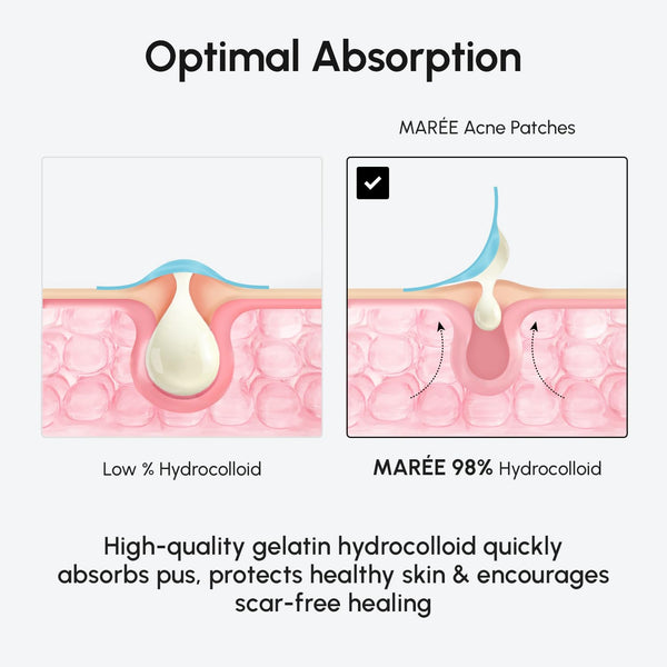 MAREE Pimple Patches for Face - Clear Acne Patches for Face - Invisible Hydrocolloid Patch Parches Para Acne Stickers Zit Dots - Cystic Zit