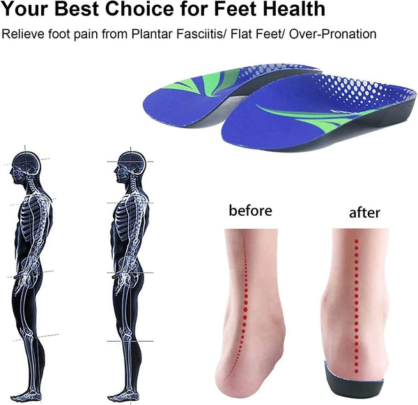 Rooruns Fitfeet Orthotic Inserts 3/4 Length, High Arch Support Foot Insoles for Over-Pronation, Plantar Fasciitis, Flat Feet - Shoe Inserts for