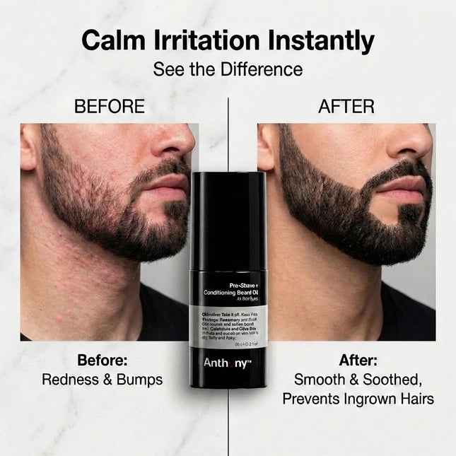 Anthony Pre-Shave and Conditioning Beard Oil, 2 Fl Oz, Contains Rosemary, Basil, Olive and Calendula Oils, Hydrates, Sof