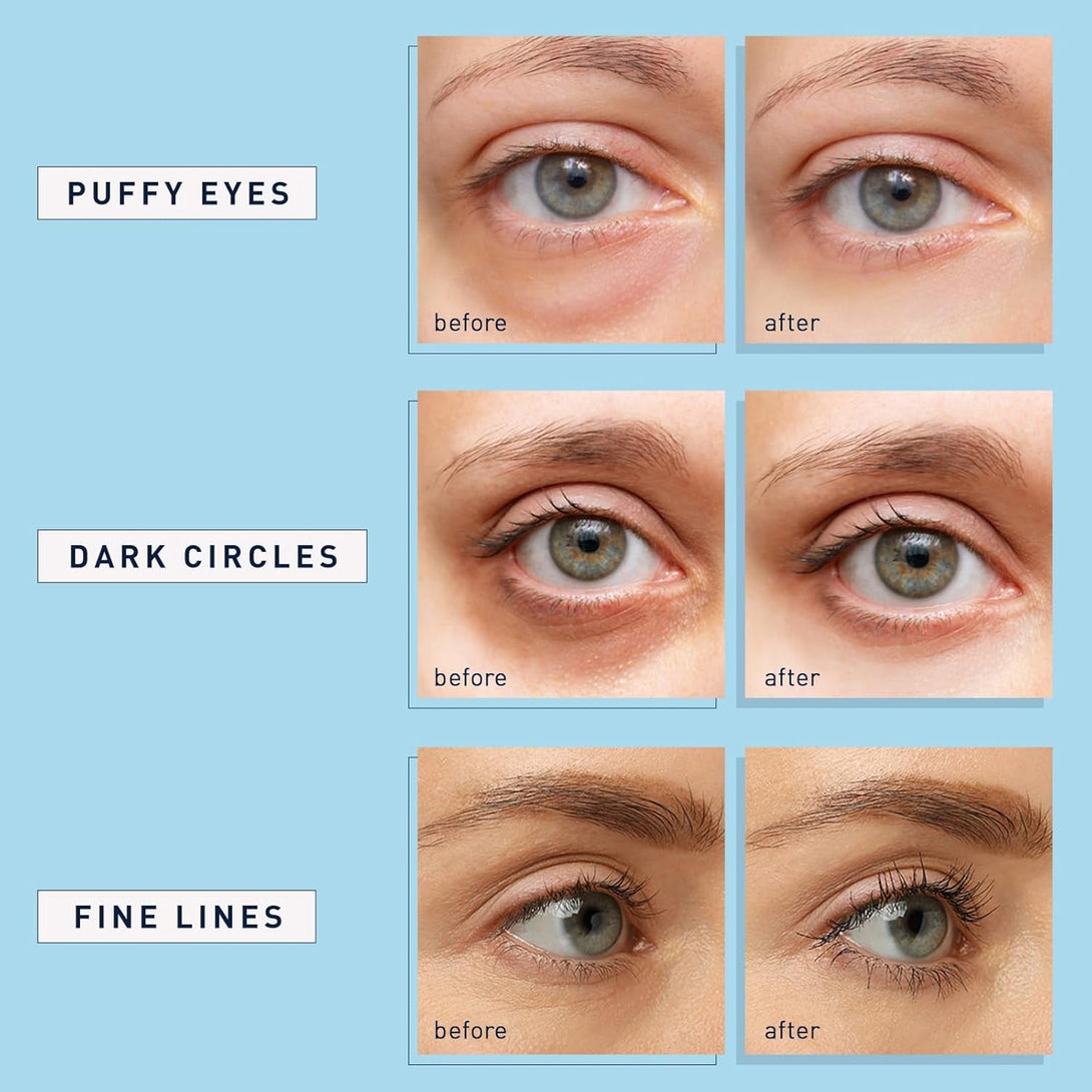 Enaskin Naturals under Eye Patches for Dark Circles: 30 Pairs Retinol Collagen Eye Gels Mask - Reduce Wrinkles Puffy & Bags - Skin Treatment Pads - anti Aging Moisturizer for Women (Blue)