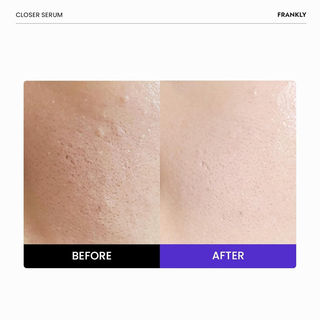 FRANKLY Closer Serum Jumbo | Pore Minimizer Serum | 9 Peptides, Vegan Collagen, Adenosine, PHA | Korean Pore Minimizer for Glass Skin, Anti-Aging, Hydration, Elasticity | 2.03 Fl Oz