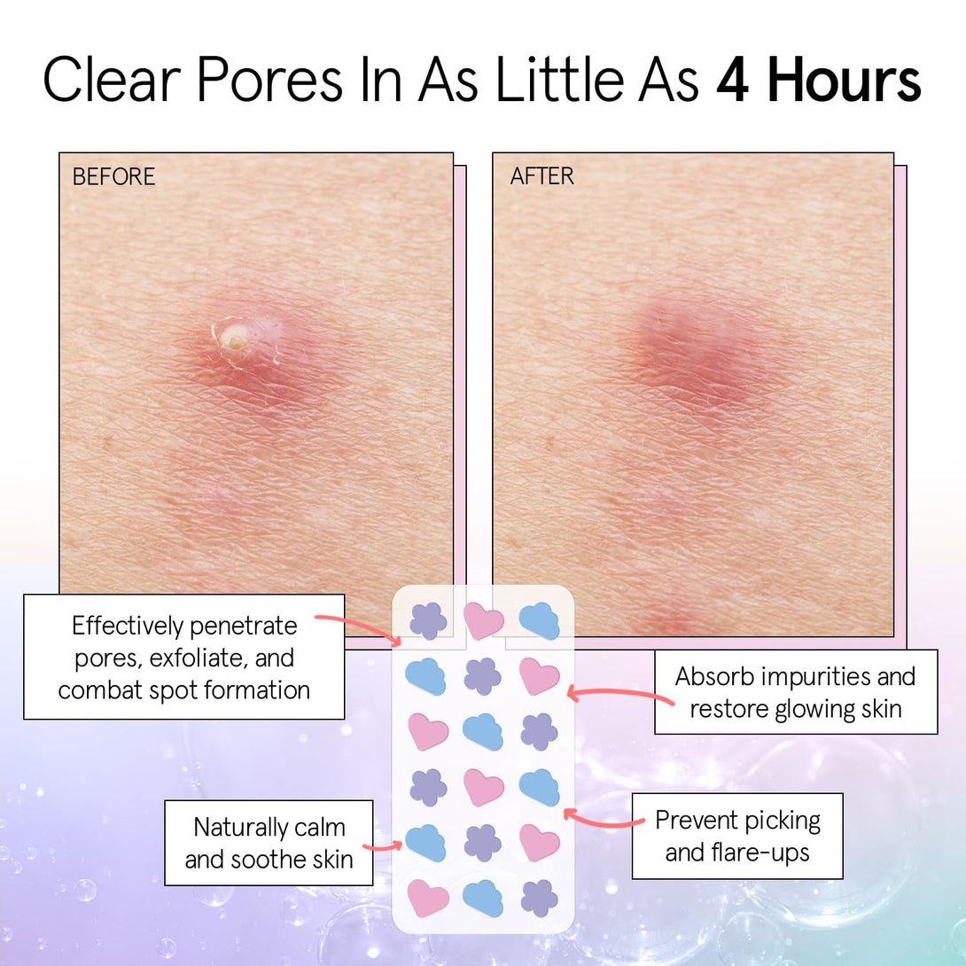 Grace & Stella Pimple Patches for Face - Cute Hydrocolloid Dots That Help Protect Acne & Reduce Redness - Fun Zit Stickers to Cover Blemishes - Dermatologist-Tested, Vegan (Multishape, 36 Count)