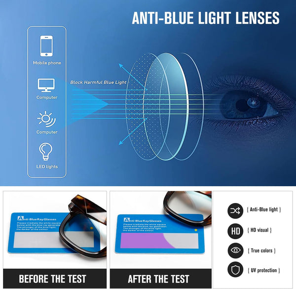 Kimorn Blue Light Blocking Glasses,Anti Eyestrain & UV Protection,Square Frame Glasses for Women and Men