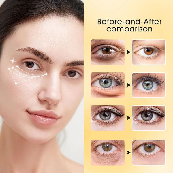 Adofect 30 Paris under Eye Patches 24K Gold under Eye Mask for Puffy Eyes and Dark Circles Treatments, under Eye Bags Treatment Collagen Gel Pads