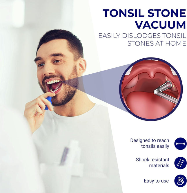 Oravix Tonsil Stone Vacuum, Tonsil Stone Remover Vacuum Suction, Tonsil Stone Cupping Tool, Tonsil Stone Removal Tool wi