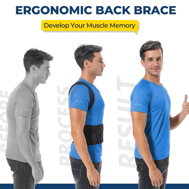 Back Brace Posture Corrector for Women and Men, Back Braces for Upper and Lower Back Pain Relief, Adjustable and Fully B