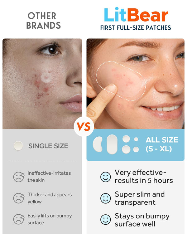 Litbear Large Acne Pimple Patches, 6 Sizes 100 Patches for Large Breakouts, Acne Patches for Face, Chin or Body, Acne Spot Treatment with Tea Tree