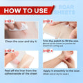 Wifamy Silicone Scar Sheets for Women: Medical Grade Scar Removal C-Section Recovery & Post-Surgery Care (1.6"X 60" Roll-1.5M)