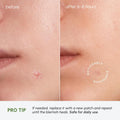 MAREE Pimple Patches for Face - Clear Acne Patches for Face - Invisible Hydrocolloid Patch Parches Para Acne Stickers Zit Dots - Cystic Zit