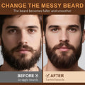 XIKEZAN 5 Pack Beard Oil Set W/Sandalwood,Orange,Vanilla,Cedarwood,Christmas Stocking Stuffers Fathers Valentines Gifts for Men Him Dad Boyfriend