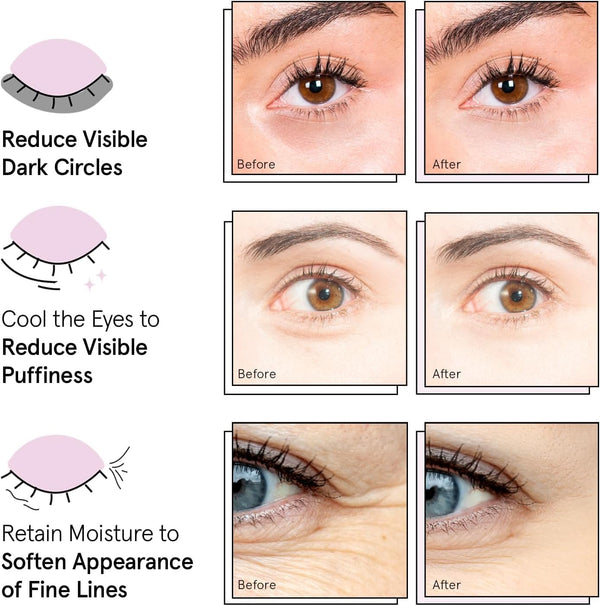 Grace & Stella Award Winning under Eye Mask - Reduce Dark Circles, Puffy Eyes, Undereye Bags, Wrinkles - Gel under Eye Patches - Gifts for Mom -