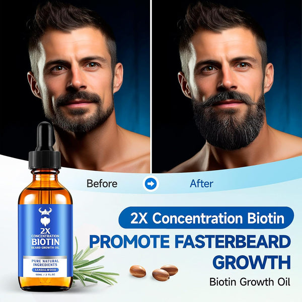Beard Growth Oil - 2X Concentration Biotin Beard Oil for Men (2 Oz) - Natural Mens Beard Oil with Argan Oil, Jojoba Oil and Vitamin, Beard Growth
