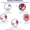 Oravix Tonsil Stone Vacuum, Tonsil Stone Remover Vacuum Suction, Tonsil Stone Cupping Tool, Tonsil Stone Removal Tool with Suction, Tonsil Stones