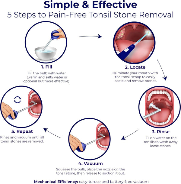 Oravix Tonsil Stone Vacuum, Tonsil Stone Remover Vacuum Suction, Tonsil Stone Cupping Tool, Tonsil Stone Removal Tool with Suction, Tonsil Stones