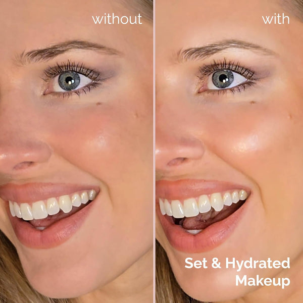 Elizabeth Mott Thank Me Later 3-in-1 Dewy Makeup Setting Spray - Hydrating & Long-Lasting Fine Mist with Niacinamide for Radiant, Glowy Skin -