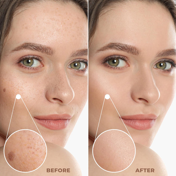 Profusion Cosmetics Lightweight Liquid Foundation for a Flawless and Elegant Radiance, Breathable Makeup for Improves Uneven Skin Tone,