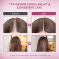 Onion & Rosemary Hair Growth Shampoo: Biotin Infused Shampoo for Hair Loss and Thinning Hair - Promotes Healthier, Thicker and Stronger Hair for