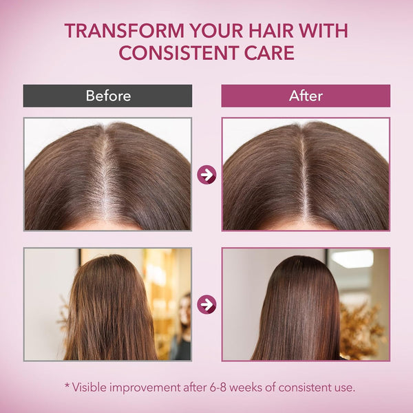 Onion & Rosemary Hair Growth Shampoo: Biotin Infused Shampoo for Hair Loss and Thinning Hair - Promotes Healthier, Thicker and Stronger Hair for