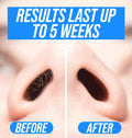 KENASHII Nose Wax Kit | 100 G Wax, 24 Applicators | Hair Removal Kit for Men and Women | Includes Balm Wipes and Mustache Guards | Lasts up to 5 Weeks