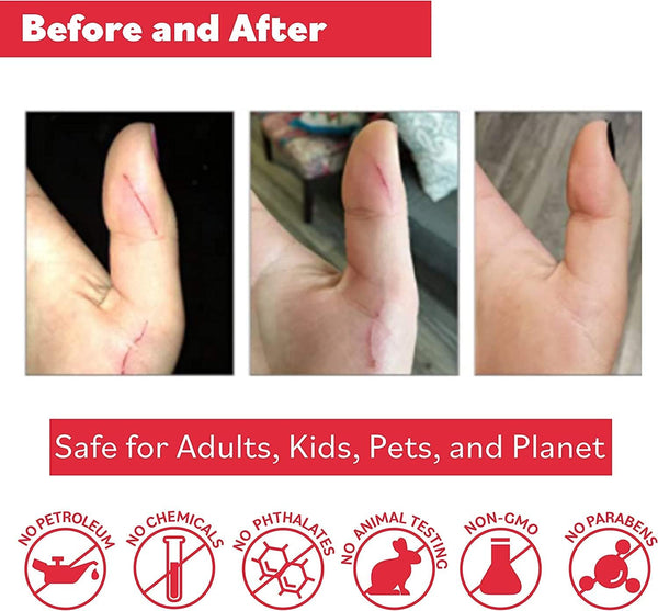Puremedy Original Healing Ointment - All Natural First Aid Salve for Wounds, Burns, Cuts, Bug Bites, Bed Sores, and Skin Irritations - Safe for