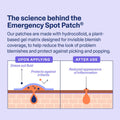 Curology Emergency Spot Pimple Patches for Face, Hydrocolloid Pimple Patches Fast-Acting, 40 Count