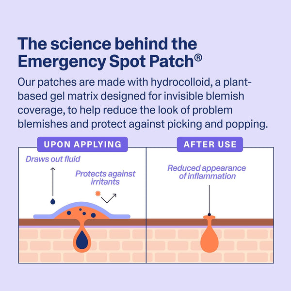 Curology Emergency Spot Pimple Patches for Face, Hydrocolloid Pimple Patches Fast-Acting, 40 Count