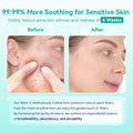 Face Towels, 10"Ã12" Disposable Face Towel, Face Towelettes XL, Ultra Soft Makeup Remover Dry Wipes, Thick Face Towel for Sensitive Skin, 50 Count