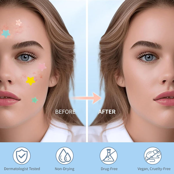 Pimple Patches for Face, Hydrocolloid Acne Patches, Cute Star Zit Covers, Colorful Spot Stickers with Tea Tree, Salicylic Acid & Cica Oil| 3 Sizes