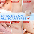 Wifamy Silicone Scar Sheets for Women: Medical Grade Scar Removal C-Section Recovery & Post-Surgery Care (1.6"X 60" Roll-1.5M)