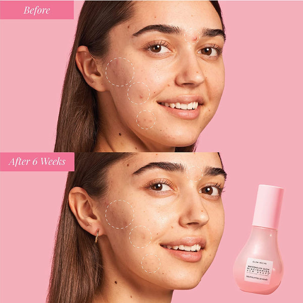 Glow Recipe Watermelon Niacinamide Dew Drops, Travel Size - Brightening, Plumping Hydrating Face Serum, Makeup Primer + Liquid Highlighter with
