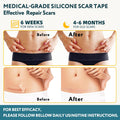 Silicone Scar Sheets, Silicone Scar Tape for Surgical Scars - 60" X 1.6" Roll - 1.5M, Medical Grade Reusable Effective Scar Removal for Keloid,