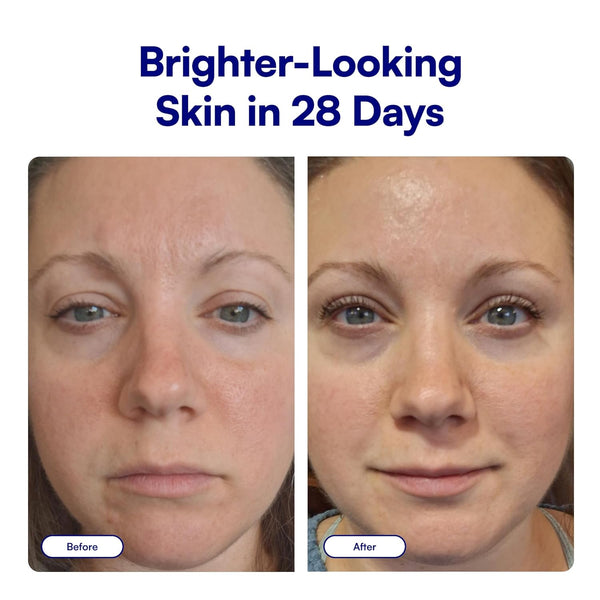 Bliss Bright Idea Vitamin C + Tri-Peptide Collagen Brightening Face Skincare Serum - anti Aging, Reduces Dark Spots, Boosts Skin Elasticity -