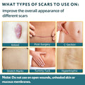Silicone Scar Sheets, Silicone Scar Tape for Surgical Scars - 60" X 1.6" Roll - 1.5M, Medical Grade Reusable Effective Scar Removal for Keloid,
