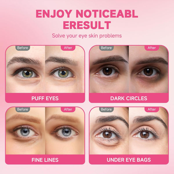 POSTA 20Pairs/40Pcs Collagen under Eye Patches, Glitter under Eye Mask for Dark Circles and Puffiness, Hydrating Eye Skincare Reduce Wrinkles and