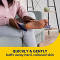 Dr. Scholl'S Callus Remover Electronic Foot File, Electric Hard Skin Removal for Feet, Effortless Soft Smooth Skin in Minutes, Perfect for Travel,