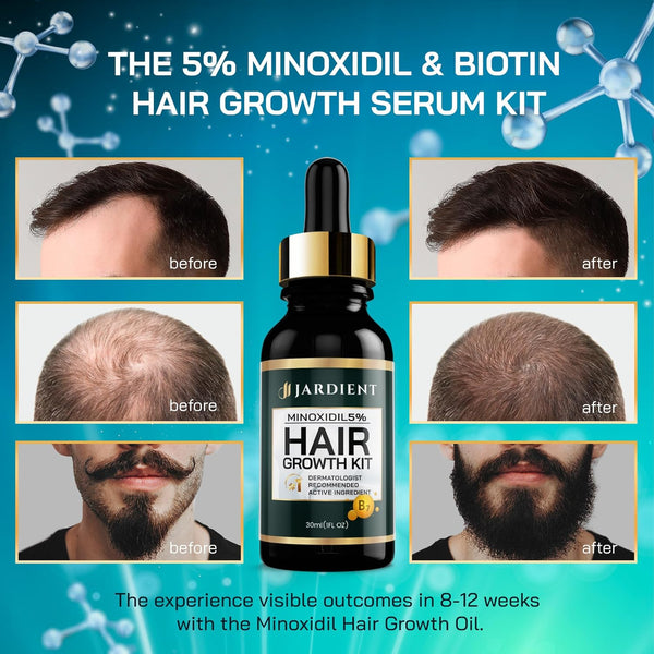 Minoxidil and Biotin Hair Growth Oil for Beards and Preventing Hair Thinning - 5% Minoxidil for Men and Women, 1 Fl Oz