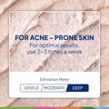 St. Ives Acne Control Face Scrub Deeply Exfoliates and Prevents Acne for Smooth, Glowing Skin Apricot Made with Oil-Free Salicylic Acid Acne