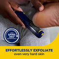 Dr. Scholl'S Callus Remover Electronic Foot File, Electric Hard Skin Removal for Feet, Effortless Soft Smooth Skin in Minutes, Perfect for Travel,