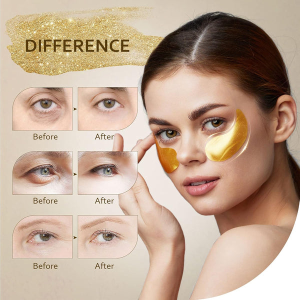 Under Eye Patches (30 Pairs), 24K Gold under Eye Mask for Puffy Eyes, Dark Circles,Bags and Wrinkles with Collagen,Relieves Pressure and Reduces