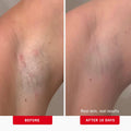 First Aid Beauty - Ingrown Hair Pads with BHA + AHA - Aftershave Treatment Pads to Help Prevent Razor Bumps for Men & Women - Exfoliate Underarms