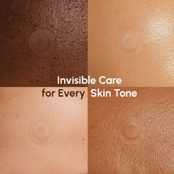 MAREE Pimple Patches for Face - Clear Acne Patches for Face - Invisible Hydrocolloid Patch Parches Para Acne Stickers Zit Dots - Cystic Zit